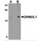 ORMDL Sphingolipid Biosynthesis Regulator 1 antibody, MBS150594, MyBioSource, Western Blot image 