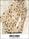 DNA Methyltransferase 3 Alpha antibody, 55-139, ProSci, Immunohistochemistry paraffin image 