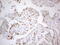 p21 antibody, LS-C791553, Lifespan Biosciences, Immunohistochemistry paraffin image 