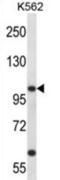 Potassium Voltage-Gated Channel Subfamily C Member 3 antibody, abx028132, Abbexa, Western Blot image 