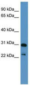 Paired Like Homeobox 2A antibody, TA343509, Origene, Western Blot image 