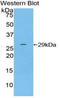 Integrin alpha-D antibody, LS-C294683, Lifespan Biosciences, Western Blot image 