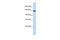 DENN Domain Containing 2C antibody, 26-798, ProSci, Enzyme Linked Immunosorbent Assay image 