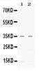 C-X-C Motif Chemokine Ligand 16 antibody, PB10054, Boster Biological Technology, Western Blot image 