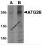 Autophagy Related 2B antibody, 7005, ProSci, Western Blot image 