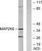 Mitogen-Activated Protein Kinase Kinase 6 antibody, TA312051, Origene, Western Blot image 