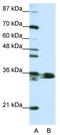 Heterogeneous Nuclear Ribonucleoprotein A1 antibody, TA345790, Origene, Western Blot image 
