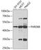 Par-6 Family Cell Polarity Regulator Beta antibody, GTX33385, GeneTex, Western Blot image 
