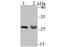 Proteasome Activator Subunit 1 antibody, A04638-1, Boster Biological Technology, Western Blot image 