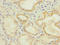 Interleukin 17 Receptor B antibody, LS-C675888, Lifespan Biosciences, Immunohistochemistry paraffin image 