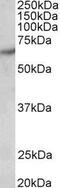 P21 (RAC1) Activated Kinase 1 antibody, GTX89274, GeneTex, Western Blot image 