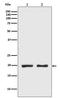 Protein Phosphatase 1 Regulatory Inhibitor Subunit 14A antibody, M05752, Boster Biological Technology, Western Blot image 