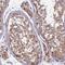 RAB28, Member RAS Oncogene Family antibody, PA5-60759, Invitrogen Antibodies, Immunohistochemistry frozen image 
