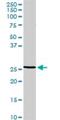 Regulator Of G Protein Signaling 20 antibody, H00008601-D01P, Novus Biologicals, Western Blot image 