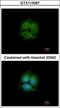 Leucine Rich Repeat Kinase 2 antibody, GTX113067, GeneTex, Immunocytochemistry image 