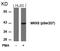 Mitogen-Activated Protein Kinase Kinase 6 antibody, PA5-37702, Invitrogen Antibodies, Western Blot image 