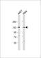 Zinc Finger And BTB Domain Containing 11 antibody, 57-095, ProSci, Western Blot image 