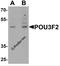 POU Class 3 Homeobox 2 antibody, 7085, ProSci, Western Blot image 