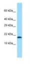 Transmembrane Protein 50B antibody, NBP1-98461, Novus Biologicals, Western Blot image 