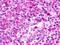 G Protein-Coupled Receptor 183 antibody, NLS46, Novus Biologicals, Immunohistochemistry paraffin image 