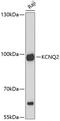Potassium Voltage-Gated Channel Subfamily Q Member 2 antibody, 18-383, ProSci, Western Blot image 