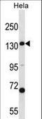 Carbamoyl-Phosphate Synthase 1 antibody, LS-C167002, Lifespan Biosciences, Western Blot image 