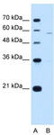 Phosphatidylinositol Glycan Anchor Biosynthesis Class V antibody, TA342041, Origene, Western Blot image 