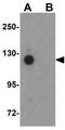 Protocadherin-18 antibody, GTX85299, GeneTex, Western Blot image 