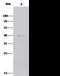 Aminoacylase-1 antibody, 10549-RP02, Sino Biological, Immunoprecipitation image 