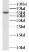 Protein Phosphatase 3 Catalytic Subunit Gamma antibody, FNab06730, FineTest, Western Blot image 