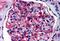 Glutamyl Aminopeptidase antibody, NB100-1885, Novus Biologicals, Immunohistochemistry paraffin image 