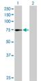 Zinc Finger Protein 133 antibody, H00007692-D01P, Novus Biologicals, Western Blot image 