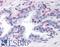 Peroxisome Proliferator Activated Receptor Gamma antibody, LS-B130, Lifespan Biosciences, Immunohistochemistry paraffin image 