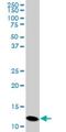 Profilin 2 antibody, H00005217-M05, Novus Biologicals, Western Blot image 