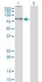 Synoviolin 1 antibody, H00084447-M01, Novus Biologicals, Western Blot image 