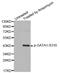 GATA Binding Protein 1 antibody, MBS128467, MyBioSource, Western Blot image 