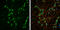 Neurofilament Light antibody, GTX101142, GeneTex, Immunofluorescence image 
