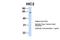 HIC ZBTB Transcriptional Repressor 2 antibody, PA5-40430, Invitrogen Antibodies, Western Blot image 