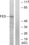 FES Proto-Oncogene, Tyrosine Kinase antibody, abx013365, Abbexa, Western Blot image 
