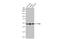 Tryptophan Hydroxylase 2 antibody, GTX101962, GeneTex, Western Blot image 