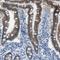 ATP Binding Cassette Subfamily G Member 5 antibody, NBP1-80712, Novus Biologicals, Immunohistochemistry paraffin image 
