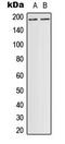 DCC Netrin 1 Receptor antibody, LS-C353964, Lifespan Biosciences, Western Blot image 