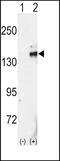 Ret Proto-Oncogene antibody, 63-127, ProSci, Western Blot image 