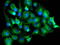 Tubulin Alpha Like 3 antibody, LS-C173531, Lifespan Biosciences, Immunofluorescence image 