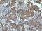 ER Membrane Protein Complex Subunit 1 antibody, 26017-1-AP, Proteintech Group, Immunohistochemistry paraffin image 