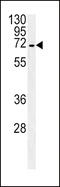 Solute Carrier Family 22 Member 1 antibody, 57-369, ProSci, Western Blot image 