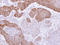 FYVE, RhoGEF And PH Domain Containing 4 antibody, LS-C186104, Lifespan Biosciences, Immunohistochemistry paraffin image 