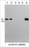 Aldehyde Dehydrogenase 1 Family Member A1 antibody, AM5621, ECM Biosciences, Western Blot image 