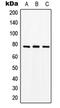Solute Carrier Family 15 Member 1 antibody, MBS822174, MyBioSource, Western Blot image 
