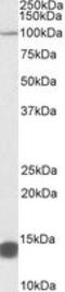 Tripartite Motif Containing 71 antibody, NBP2-27491, Novus Biologicals, Western Blot image 